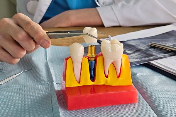 Reasons You May Not Be A Candidate For Dental Implants And How To Fix It